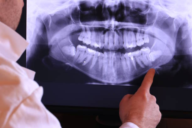 Best Emergency Root Canal Treatment in Matawan, NJ