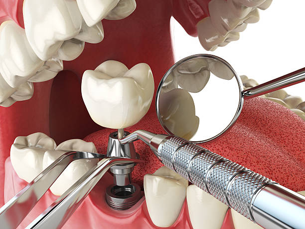 Fast & Reliable Emergency Dental Services in NJ